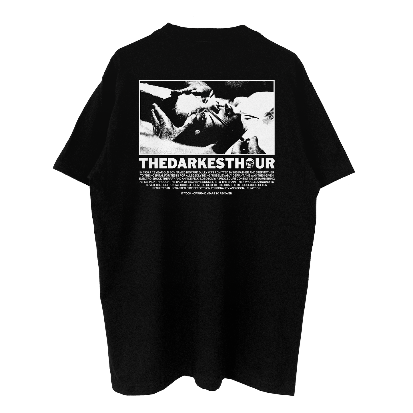"MY LOBOTOMY" TEE